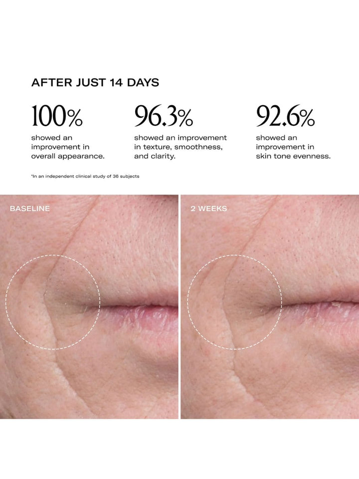 Le Prunier Plum Beauty Oil Results | Twentyseven Toronto