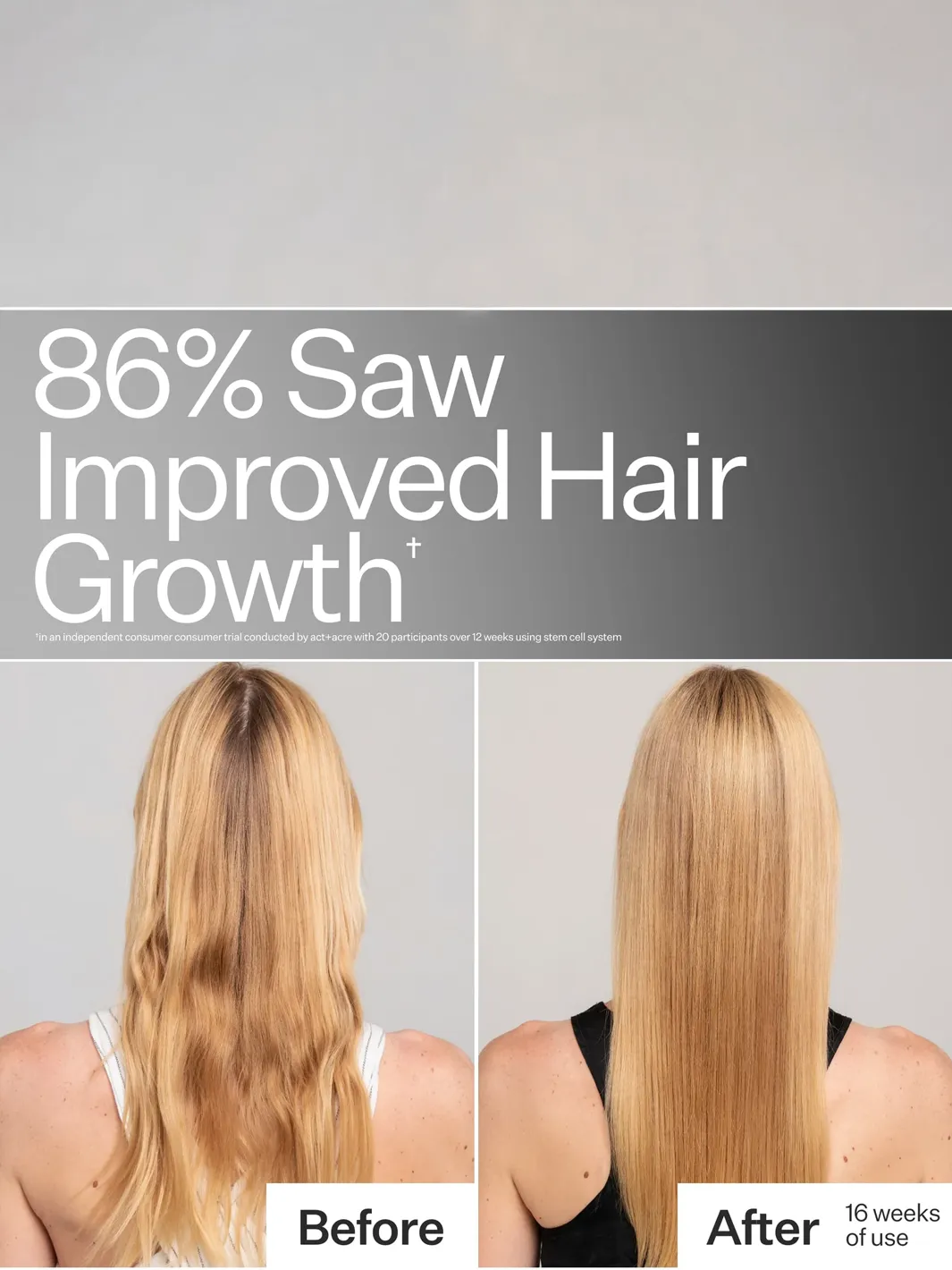 Act+Acre Stem Cell System before-and-after showing healthier-looking hair after 16 weeks of use | Twentyseven Toronto