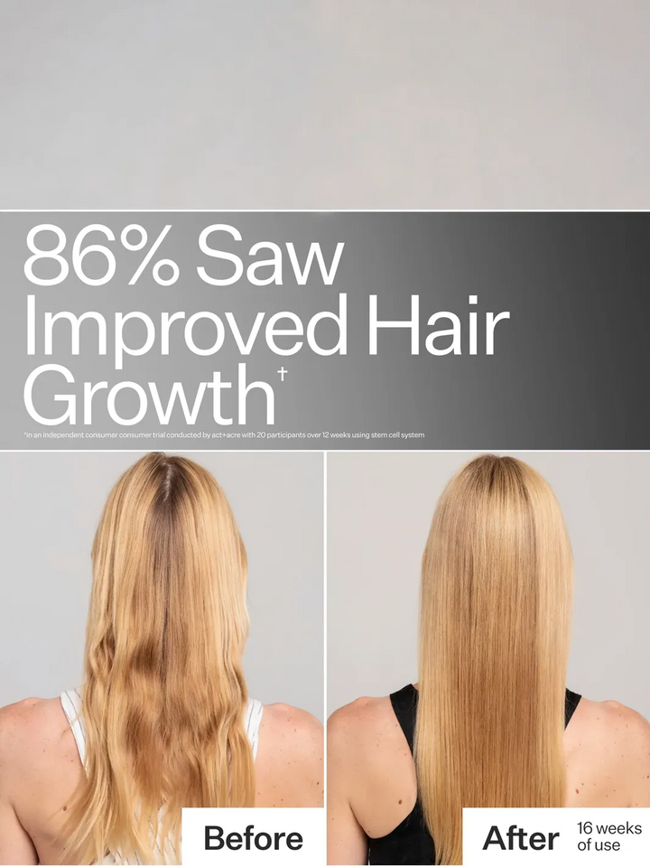 Act+Acre Stem Cell System before-and-after showing healthier-looking hair after 16 weeks of use | Twentyseven Toronto