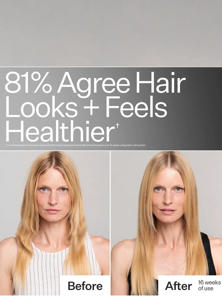 Act+Acre Stem Cell System before-and-after showing improved hair growth after 16 weeks of use | Twentyseven Toronto