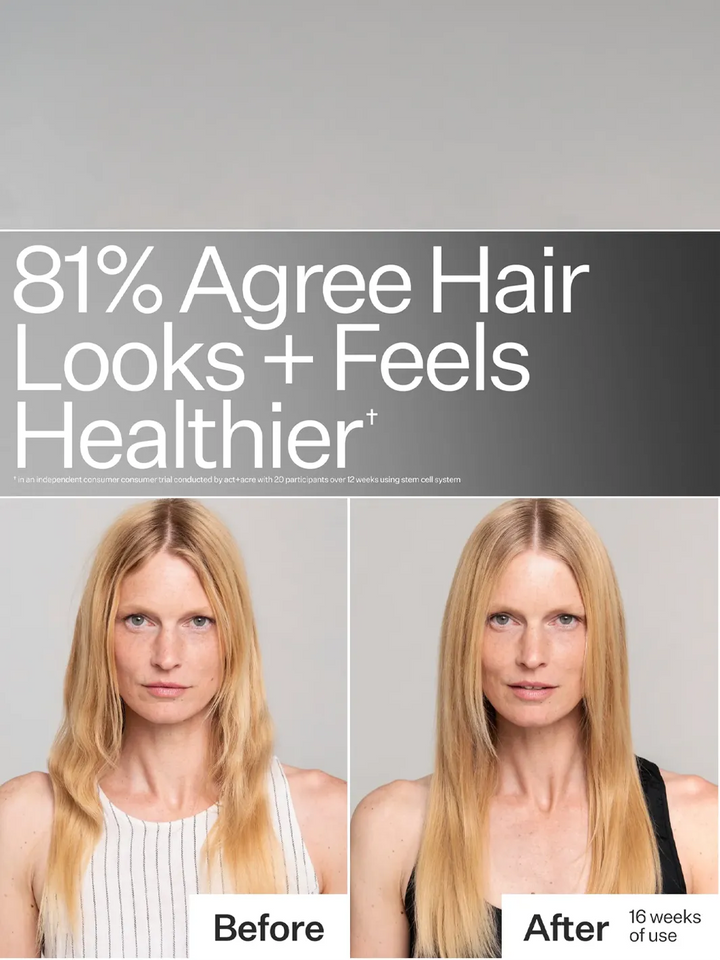 Act+Acre Stem Cell System before-and-after showing healthier-looking hair after 16 weeks of use | Twentyseven Toronto