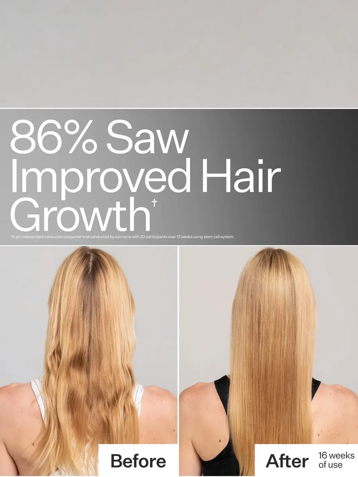Act+Acre Stem Cell System before-and-after showing improved hair growth after 16 weeks of use | Twentyseven Toronto