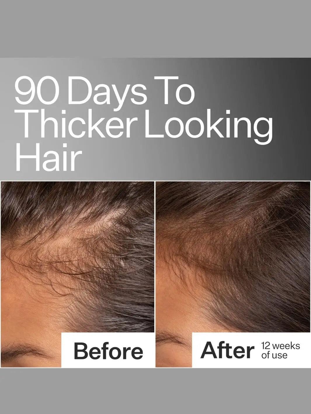 Before and after comparison of hair thickness using Act+Acre Cold Processed Apple Stem Cell Scalp Serum with text detailing '90 Days To Thicker Looking Hair' on a gray background | Twentyseven Toronto