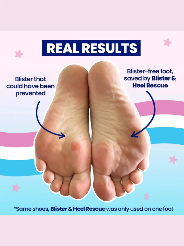 A side-by-side comparison shows the soles of two feet labeled "Real Results," highlighting one with a blister and one saved by Megababe Blister & Heel Rescue | Twentyseven Toronto