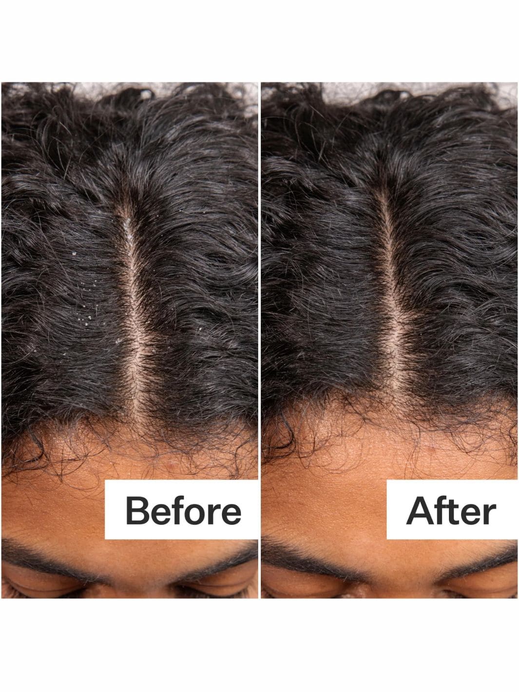 Act+Acre Daily Hydro™ Scalp Serum | 1 oz | Twentyseven Toronto