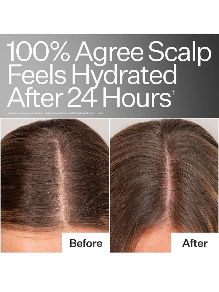 Act+Acre Daily Hydro™ Scalp Serum | 1 oz | Twentyseven Toronto