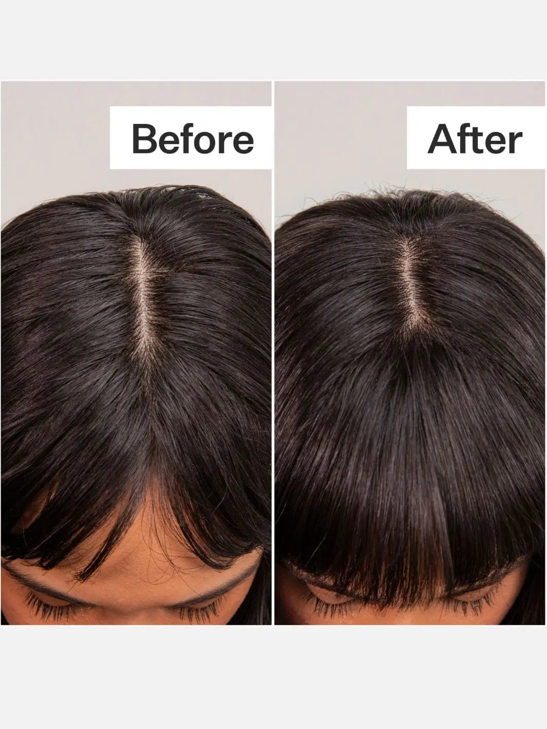 Before and after comparison of using Act+Acre Fulvic Acid Dry Shampoo | Twentyseven Toronto