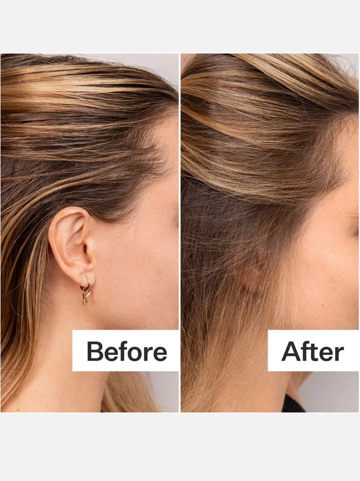 Before and after comparison of using Act+Acre Fulvic Acid Dry Shampoo | Twentyseven Toronto