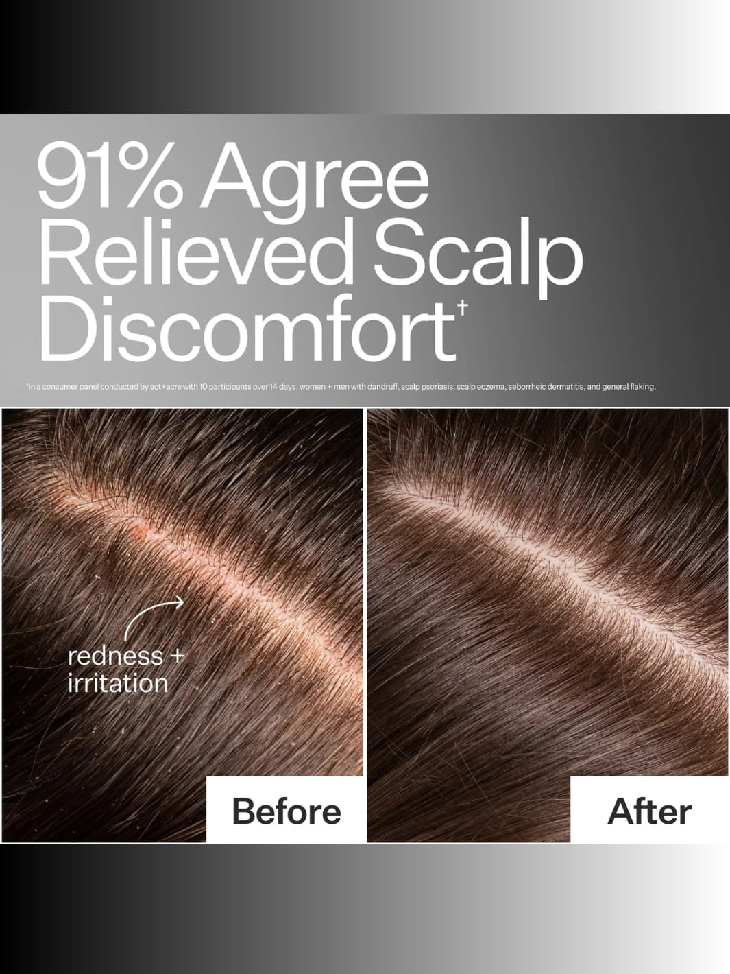 Instant Scalp Relief Pro System