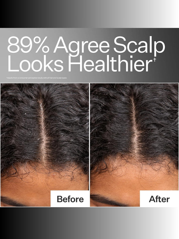 Instant Scalp Relief Pro System