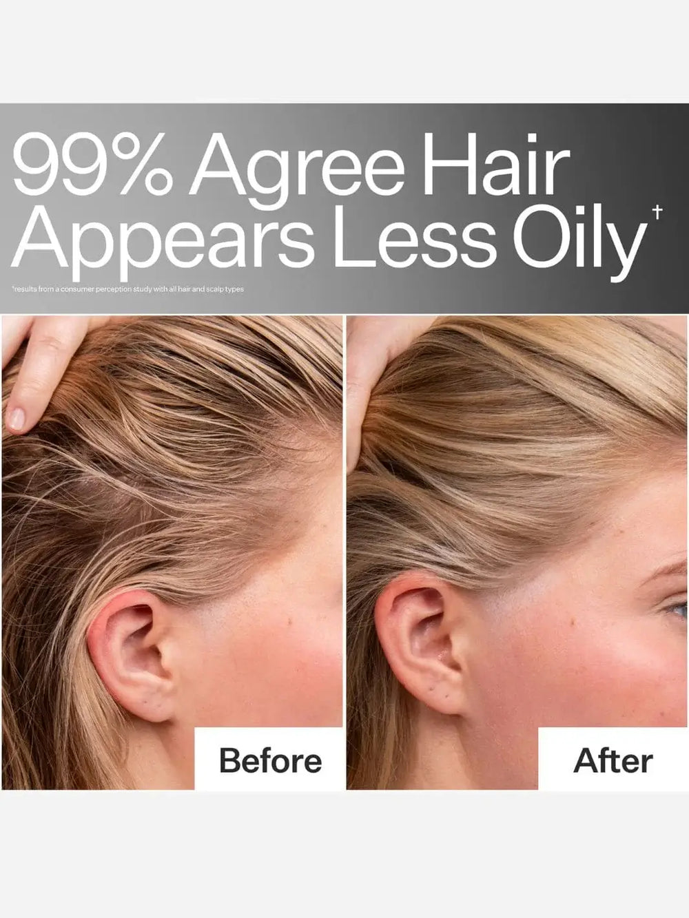 Before and after comparison of hair appearance after using Act+Acre Niacinamide Oily Scalp Serum with text indicating reduced oiliness | Twentyseven Toronto