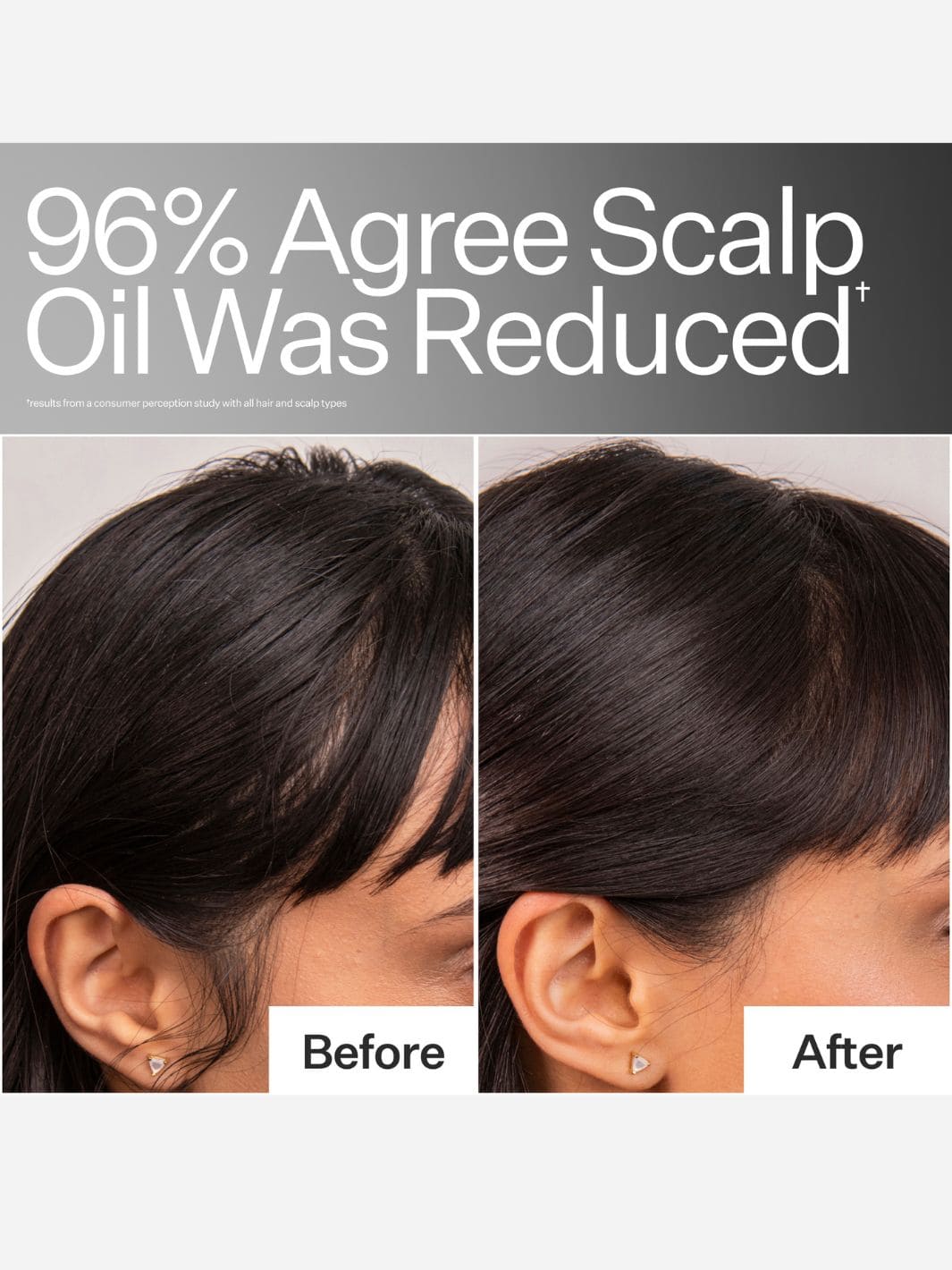 Act+Acre 4% Niacinamide Oily Scalp Serum Clean Treatment for Oily Scalps 65ml | Twentyseven Toronto