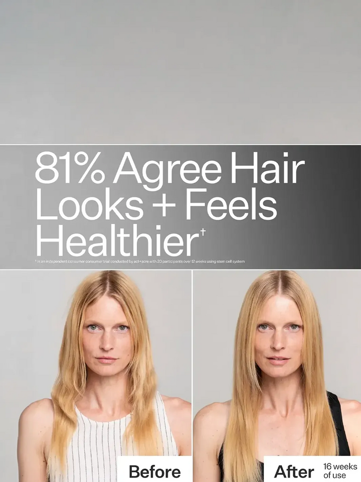Act+Acre Stem Cell System before-and-after showing improved hair growth after 16 weeks of use | Twentyseven Toronto