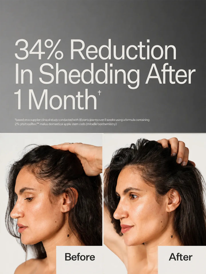 Before and after hair results highlighting a 34% reduction in shedding after one month with a formula containing 2% apple stem cells | Twentyseven Toronto
