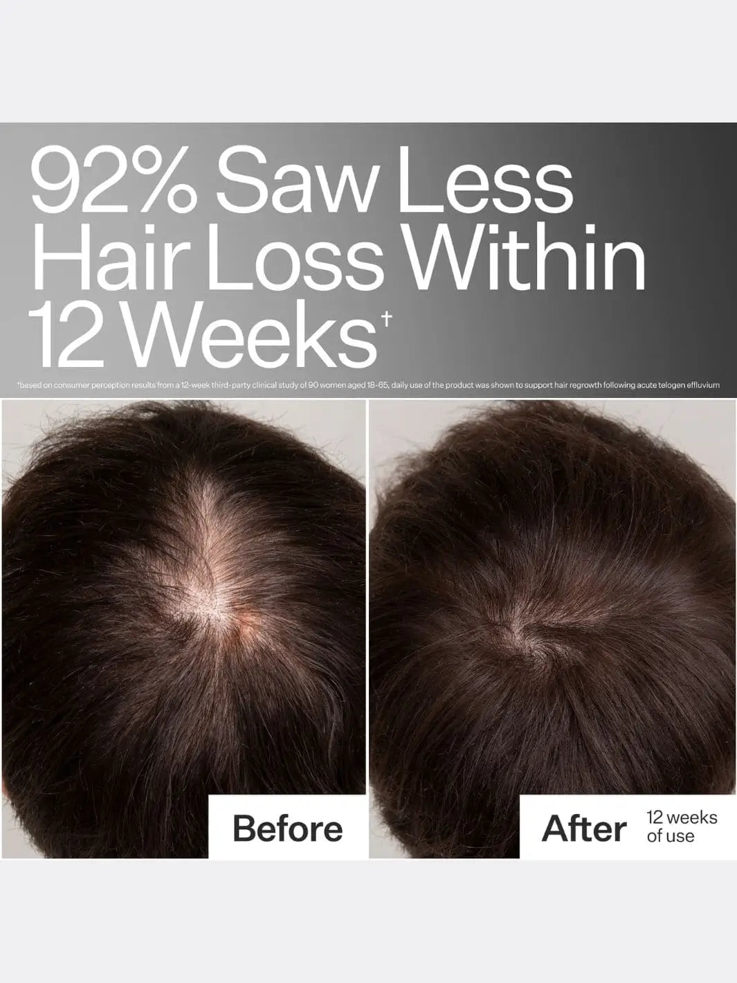 Before and after comparison of hair loss reduction after using Act+Acre Stem Cell Peptide Serum with text indicating 92% less hair loss within 12 weeks | Twentyseven Toronto
