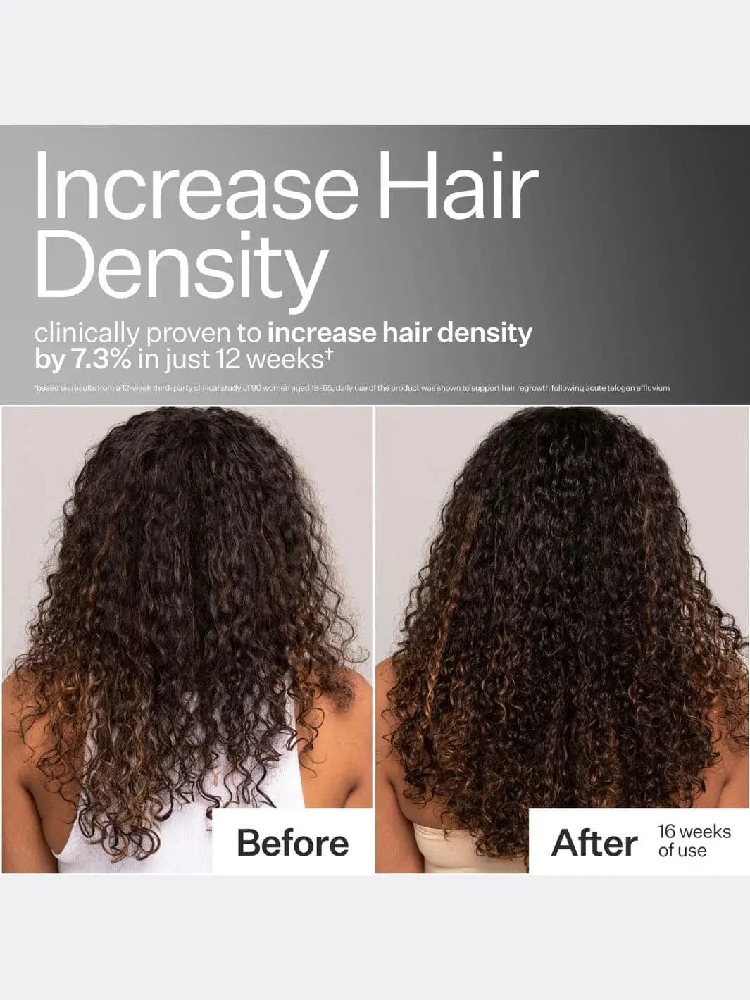 Before and after comparison of hair density increase after using Act+Acre Stem Cell Peptide Serum with text indicating clinical proven results | Twentyseven Toronto