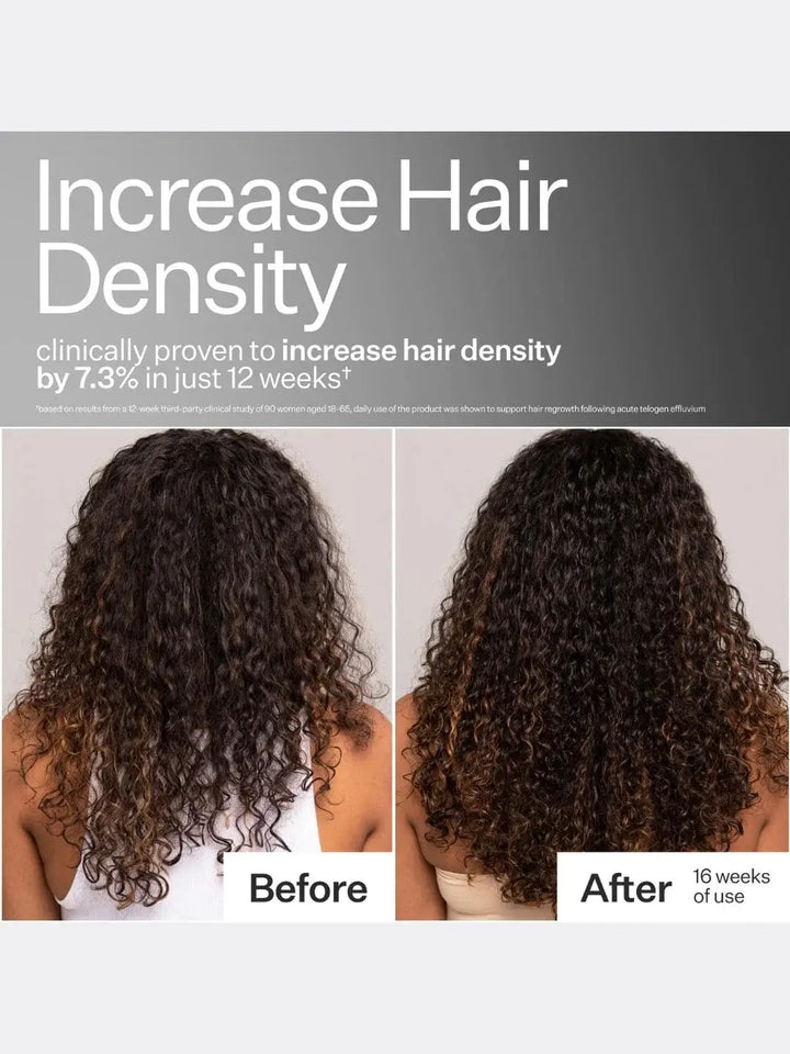 Before and after comparison of hair density increase after using Act+Acre Stem Cell Peptide Serum with text indicating clinical proven results | Twentyseven Toronto