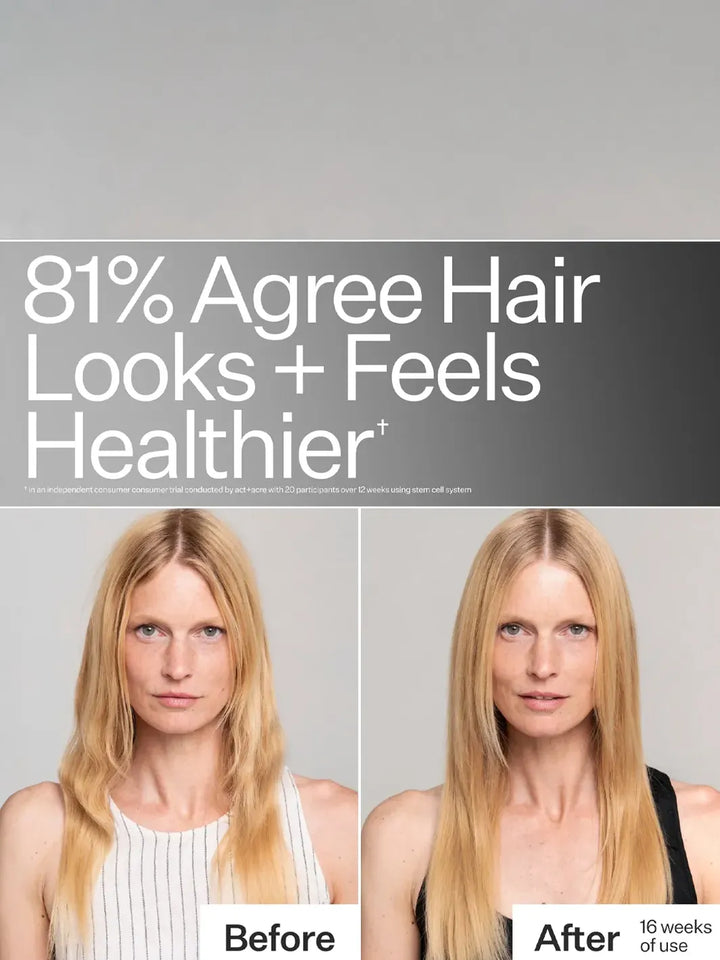 Act+Acre Stem Cell System before-and-after showing healthier-looking hair after 16 weeks of use | Twentyseven Toronto