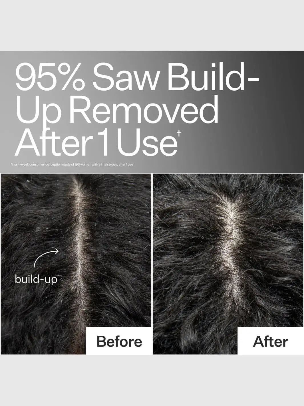 Before and after comparison of using Act+Acre Scalp Detox showing 95% build-up removed | Twentysveen Toronto